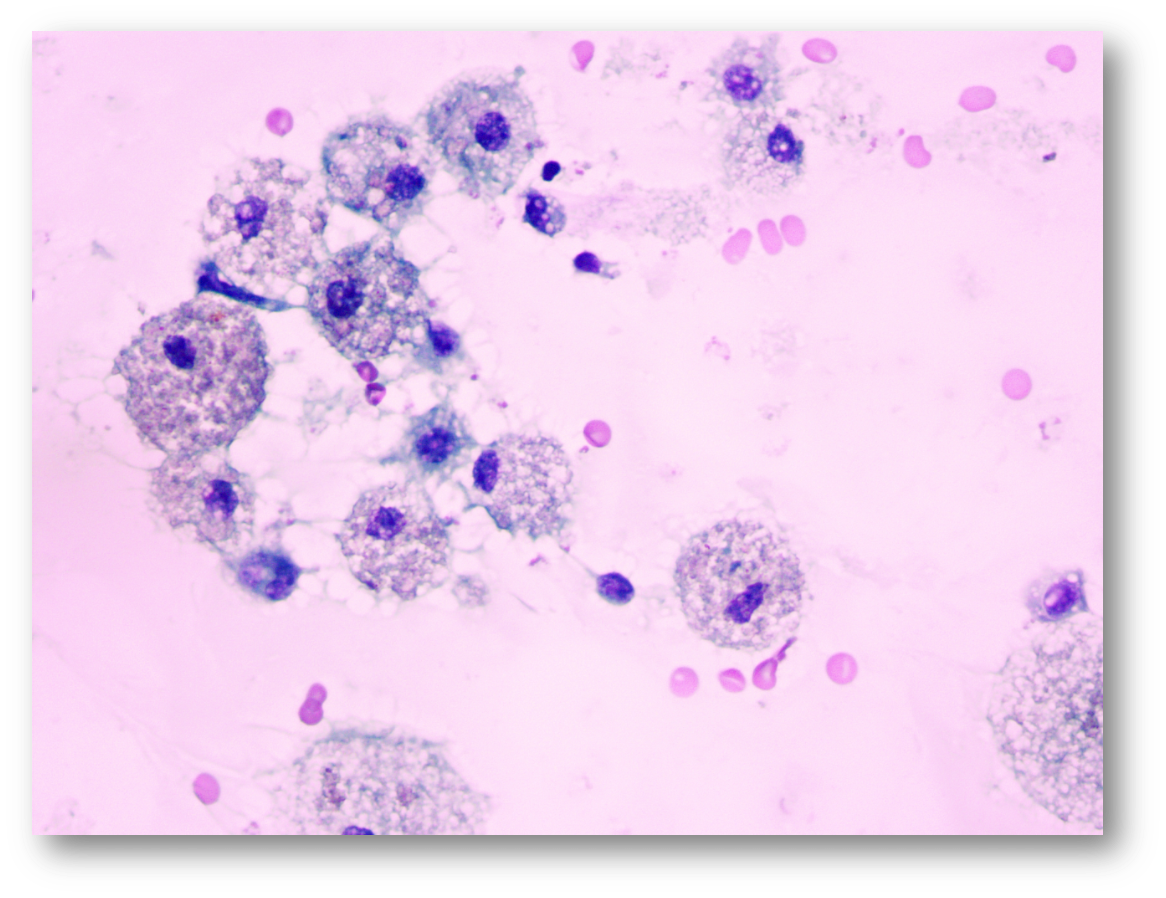 Citologia - Bethesda I